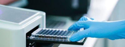 Clinical Utility of IgG4 Testing-small-1